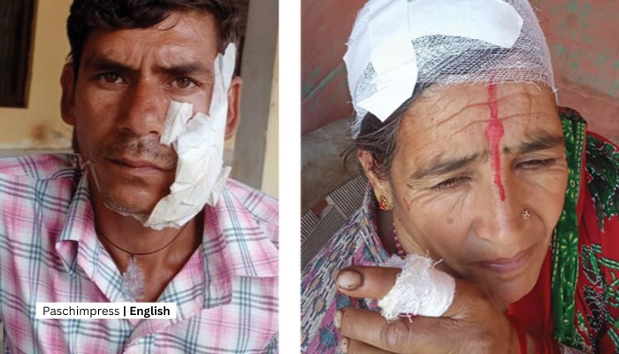 Baitadi's Battle Against Nature: Farmers Face Perilous Wildlife Encounters